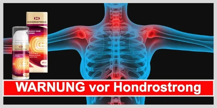 Arthrolon ár a gyógyszertárban, vásárlás, hatás, felülvizsgálat.