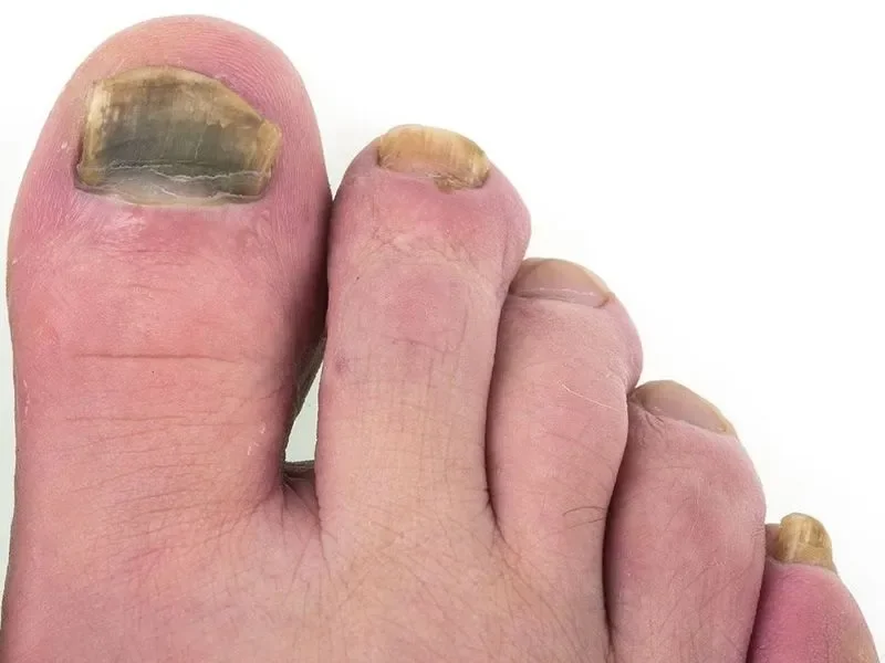 Foot trooper vásárolni a gyógyszertárban, ára, összetétel, forum, vásárlók és orvosok vélemények.