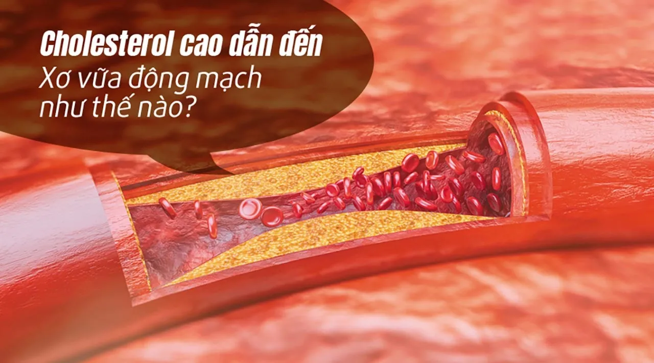 Premium shiitake cardio ár a gyógyszertárban, vásárlás, hatás, felülvizsgálat.