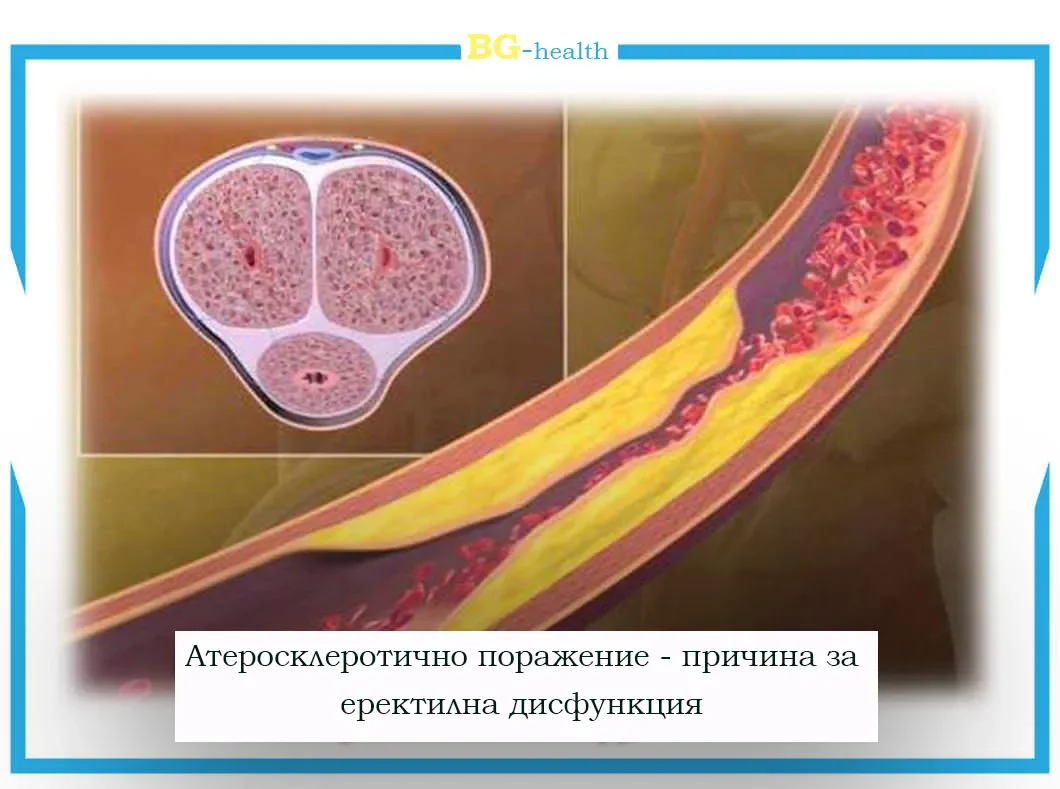 Rhino gold gel vásárolni a gyógyszertárban, ára, összetétel, forum, vásárlók és orvosok vélemények.